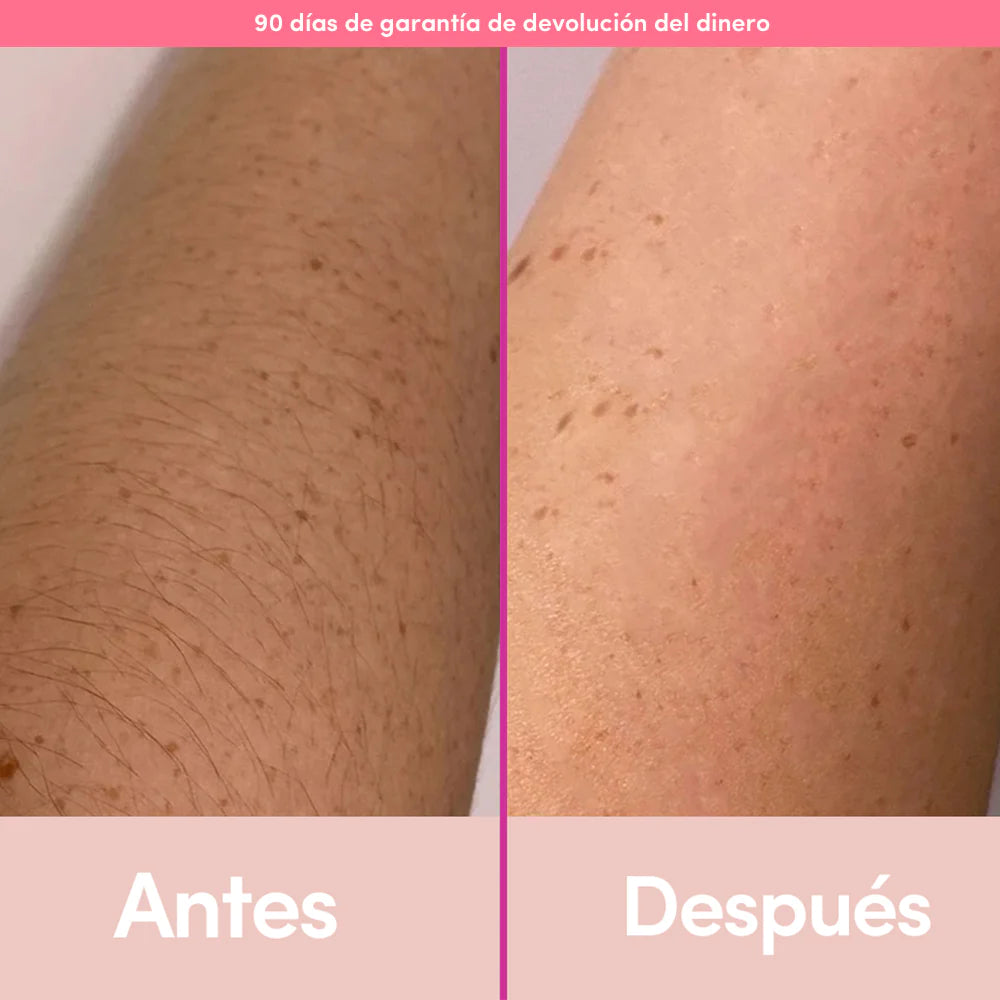 PULSED™ - DEPILADORA LÁSER