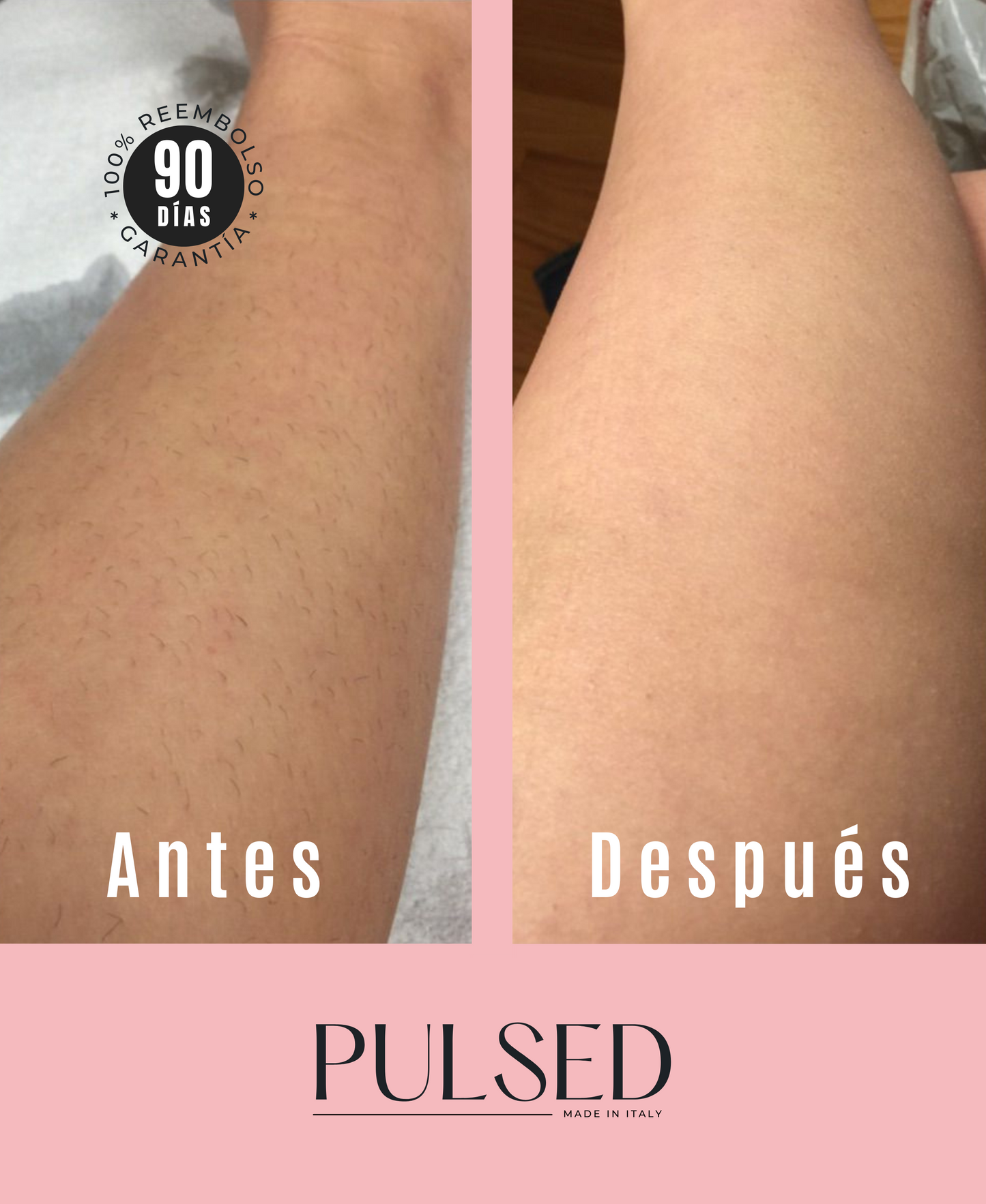 PULSED™ - DEPILADORA LÁSER