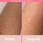PULSED™ - DEPILADORA LÁSER